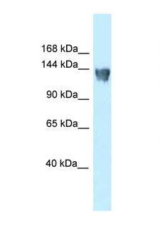 XPO5 / Exportin 5 Antibody - XPO5 / Exportin-5 antibody Western blot of Rat Liver lysate. Antibody concentration 1 ug/ml.  This image was taken for the unconjugated form of this product. Other forms have not been tested.