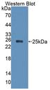 XPO5 / Exportin 5 Antibody - Western Blot; Sample: Recombinant protein.