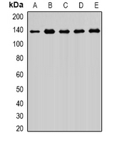 XPO5 / Exportin 5 Antibody - Western blot analysis of Exportin 5 expression in MCF7 (A); HIH3T3 (B); PC12 (C); mouse brain (D); rat brain (E) whole cell lysates.