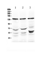 XPO5 / Exportin 5 Antibody - Western blot analysis of Exportin-5 using anti-Exportin-5 antibody. Electrophoresis was performed on a 5-20% SDS-PAGE gel at 70V (Stacking gel) / 90V (Resolving gel) for 2-3 hours. The sample well of each lane was loaded with 50ug of sample under reducing conditions. Lane 1: rat testis tissue lysate,Lane 2: mouse testis tissue lysate,Lane 3: human Hela whole cell lysate. After Electrophoresis, proteins were transferred to a Nitrocellulose membrane at 150mA for 50-90 minutes. Blocked the membrane with 5% Non-fat Milk/ TBS for 1.5 hour at RT. The membrane was incubated with rabbit anti-Exportin-5 antigen affinity purified polyclonal antibody at 0.5 µg/mL overnight at 4°C, then washed with TBS-0.1% Tween 3 times with 5 minutes each and probed with a goat anti-rabbit IgG-HRP secondary antibody at a dilution of 1:10000 for 1.5 hour at RT. The signal is developed using an Enhanced Chemiluminescent detection (ECL) kit with Tanon 5200 system. A specific band was detected for Exportin-5 at approximately 136KD. The expected band size for Exportin-5 is at 136KD.