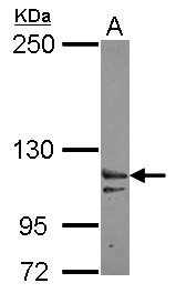 XPO6 Antibody - Sample (30 ug of whole cell lysate) A: IMR32 5% SDS PAGE XPO6 antibody diluted at 1:3000