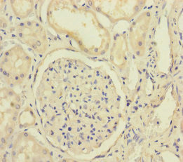 XPO6 Antibody - Immunohistochemistry of paraffin-embedded human kidney tissue at dilution of 1:100