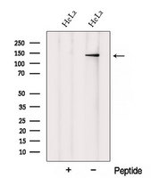 XPO6 Antibody - Western blot analysis of extracts of B16F10 cells using XPO6 antibody. The lane on the left was treated with blocking peptide.