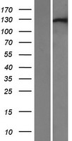 XPO6 Protein - Western validation with an anti-DDK antibody * L: Control HEK293 lysate R: Over-expression lysate