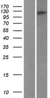 XPO7 Protein - Western validation with an anti-DDK antibody * L: Control HEK293 lysate R: Over-expression lysate