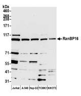 XPO7 / RANBP16 Antibody - Detection of human and mouse RanBP16 by western blot. Samples: Whole cell lysate (15 µg) from Jurkat, A-549, Hep-G2, mouse TCMK-1, and mouse NIH 3T3 cells prepared using NETN lysis buffer. Antibody: Affinity purified rabbit anti-RanBP16 antibody used for WB at 1:1000. Detection: Chemiluminescence with an exposure time of 30 seconds.