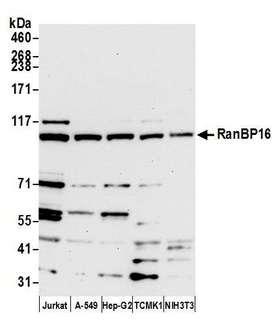 XPO7 / RANBP16 Antibody - Detection of human and mouse RanBP16 by western blot. Samples: Whole cell lysate (15 µg) from Jurkat, A-549, Hep-G2, mouse TCMK-1, and mouse NIH 3T3 cells prepared using NETN lysis buffer. Antibody: Affinity purified rabbit anti-RanBP16 antibody used for WB at 1:1000. Detection: Chemiluminescence with an exposure time of 30 seconds.