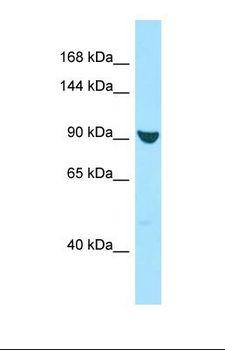 XPO7 / RANBP16 Antibody - Western blot of Human 721_B. XPO7 antibody dilution 1.0 ug/ml.  This image was taken for the unconjugated form of this product. Other forms have not been tested.