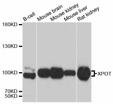 XPOT / Exportin-T Antibody - Western blot analysis of extracts of various cell lines, using XPOT antibody at 1:3000 dilution. The secondary antibody used was an HRP Goat Anti-Rabbit IgG (H+L) at 1:10000 dilution. Lysates were loaded 25ug per lane and 3% nonfat dry milk in TBST was used for blocking. An ECL Kit was used for detection and the exposure time was 10s.