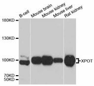 XPOT / Exportin-T Antibody - Western blot analysis of extracts of various cell lines, using XPOT antibody at 1:3000 dilution. The secondary antibody used was an HRP Goat Anti-Rabbit IgG (H+L) at 1:10000 dilution. Lysates were loaded 25ug per lane and 3% nonfat dry milk in TBST was used for blocking. An ECL Kit was used for detection and the exposure time was 10s.