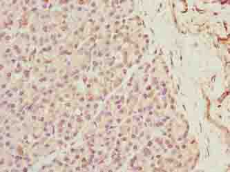 XPR1 Antibody - Immunohistochemistry of paraffin-embedded human pancreatic tissue using antibody at dilution of 1:100.
