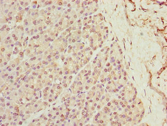 XPR1 Antibody - Immunohistochemistry of paraffin-embedded human pancreatic tissue using XPR1 Antibody at dilution of 1:100