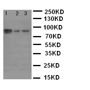 XRCC1 Antibody - WB of XRCC1 antibody. Lane 1: 293T Cell Lysate. Lane 2: A431 Cell Lysate. Lane 3: HELA Cell Lysate.