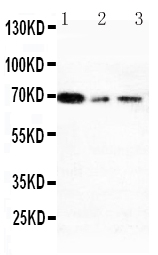 XRCC1 Antibody - Anti-XRCC1 antibody, Western blotting Lane 1: 293T Cell LysateLane 2: A431 Cell LysateLane 3: HELA Cell Lysate