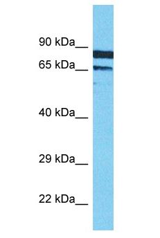 XRCC1 Antibody - XRCC1 antibody Western Blot of MCF7. Antibody dilution: 1 ug/ml.  This image was taken for the unconjugated form of this product. Other forms have not been tested.