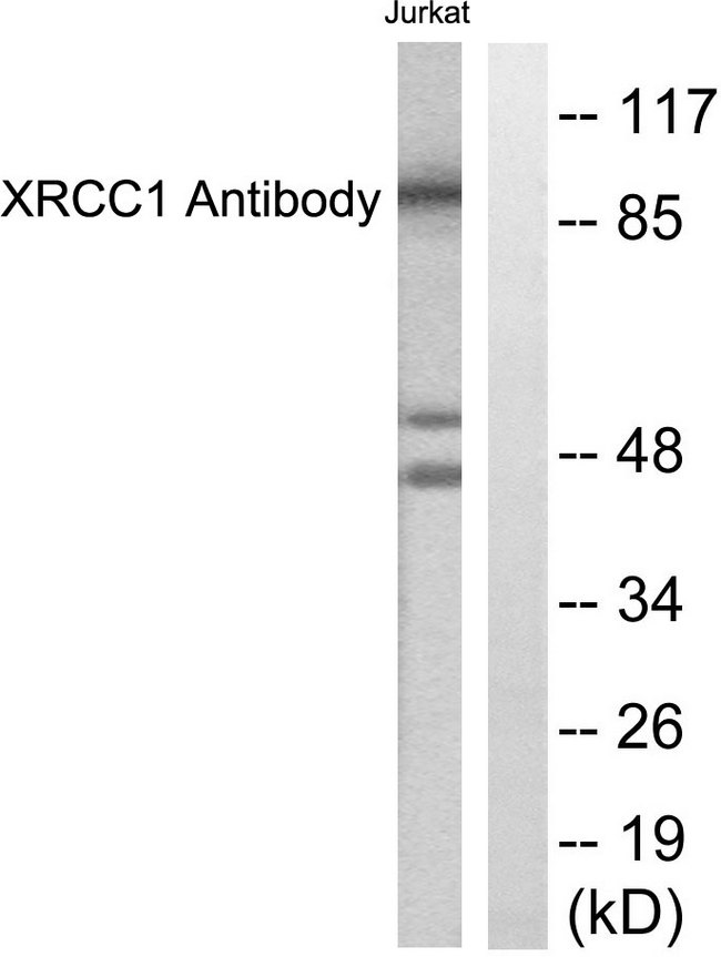 XRCC1 Antibody - Western blot analysis of lysates from Jurkat cells, using XRCC1 Antibody. The lane on the right is blocked with the synthesized peptide.