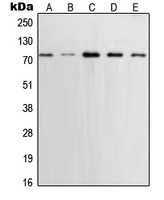 XRCC1 Antibody - Western blot analysis of XRCC1 expression in MCF7 (A); U2OS (B); A431 (C); SHSY5Y (D); Saos2 (E) whole cell lysates.