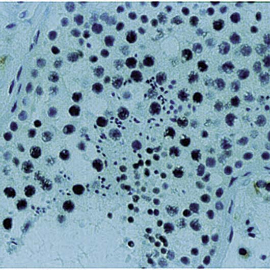 XRCC1 Antibody - Formalin-fixed, paraffin-embedded human testis stained with XRCC-1 antibody.