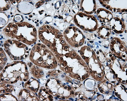 XRCC1 Antibody - Immunohistochemical staining of paraffin-embedded Kidney tissue using anti-XRCC1 mouse monoclonal antibody. (Dilution 1:50).
