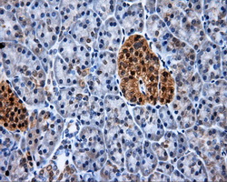 XRCC1 Antibody - Immunohistochemical staining of paraffin-embedded pancreas tissue using anti-XRCC1 mouse monoclonal antibody. (Dilution 1:50).