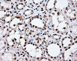 XRCC1 Antibody - Immunohistochemical staining of paraffin-embedded Kidney tissue using anti- mouse monoclonal antibody. (Dilution 1:50).