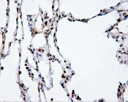 XRCC1 Antibody - Immunohistochemical staining of paraffin-embedded lung tissue using anti- mouse monoclonal antibody. (Dilution 1:50).