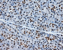XRCC1 Antibody - Immunohistochemical staining of paraffin-embedded pancreas tissue using anti- mouse monoclonal antibody. (Dilution 1:50).