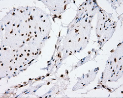 XRCC1 Antibody - Immunohistochemical staining of paraffin-embedded bladder tissue using anti- mouse monoclonal antibody. (Dilution 1:50).