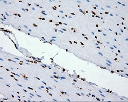 XRCC1 Antibody - Immunohistochemical staining of paraffin-embedded colon tissue using anti- mouse monoclonal antibody. (Dilution 1:50).