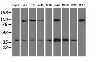XRCC1 Antibody - Western blot of extracts (35 ug) from 9 different cell lines by using anti-XRCC1 monoclonal antibody.