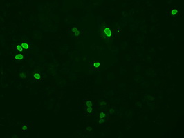 XRCC1 Antibody - Anti-XRCC1 mouse monoclonal antibody  immunofluorescent staining of COS7 cells transiently transfected by pCMV6-ENTRY XRCC1.