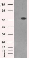 XRCC1 Antibody - HEK293T cells were transfected with the pCMV6-ENTRY control (Left lane) or pCMV6-ENTRY XRCC1 (Right lane) cDNA for 48 hrs and lysed. Equivalent amounts of cell lysates (5 ug per lane) were separated by SDS-PAGE and immunoblotted with anti-XRCC1.