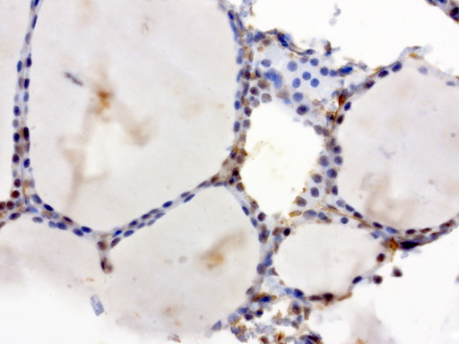 XRCC1 Antibody - Immunohistochemical staining of paraffin-embedded human thyroid using anti-XRCC1 clone UMAB40 mouse monoclonal antibody  at 1:50 with Polink2 Broad HRP DAB detection kit; heat-induced epitope retrieval with GBI TEE pH9.0 HIER buffer using pressure chamber for 3 minutes at 110C. Nuclear staining is seen in epithelial cells.