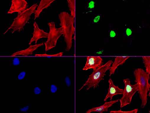XRCC1 Antibody - Immunofluorescent staining of HeLa cells using anti-XRCC1 mouse monoclonal antibody  green). Actin filaments were labeled with TRITC-phalloidin. (red), and nuclear with DAPI. (blue). The three-color overlay image is located at the bottom-right corner.
