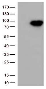 XRCC1 Antibody - HEK293T cells were transfected with the pCMV6-ENTRY control. (Left lane) or pCMV6-ENTRY XRCC1. (Right lane) cDNA for 48 hrs and lysed. Equivalent amounts of cell lysates. (5 ug per lane) were separated by SDS-PAGE and immunoblotted with anti-XRCC1. (1:1000)