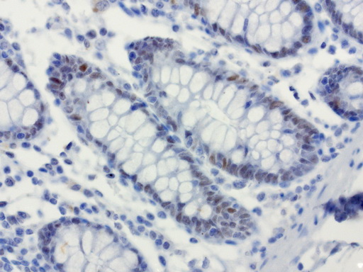 XRCC1 Antibody - Immunohistochemical staining of paraffin-embedded human colon using anti-XRCC1 clone UMAB40 mouse monoclonal antibody  at 1:50 with Polink2 Broad HRP DAB detection kit; heat-induced epitope retrieval with GBI Accel pH8.7 HIER buffer using pressure chamber for 3 minutes at 110C. Nuclear staining is seen in epithelial cells.