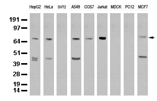 XRCC1 Antibody - Western blot analysis of extracts. (35ug) from 9 different cell lines by using anti-XRCC1 monoclonal antibody. (Clone UMAB40) at 1:500.