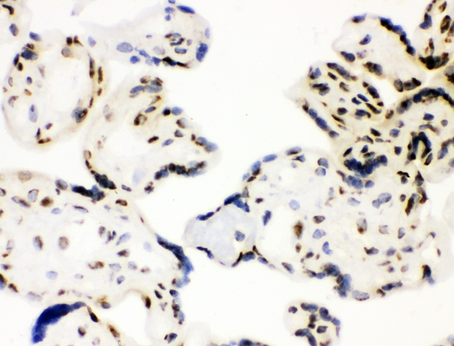 XRCC1 Antibody - IHC analysis of XRCC1 using anti-XRCC1 antibody. XRCC1 was detected in frozen section of human placenta tissues. Heat mediated antigen retrieval was performed in citrate buffer (pH6, epitope retrieval solution) for 20 mins. The tissue section was blocked with 10% goat serum. The tissue section was then incubated with 1µg/ml rabbit anti-XRCC1 Antibody overnight at 4°C. Biotinylated goat anti-rabbit IgG was used as secondary antibody and incubated for 30 minutes at 37°C. The tissue section was developed using Strepavidin-Biotin-Complex (SABC) with DAB as the chromogen.