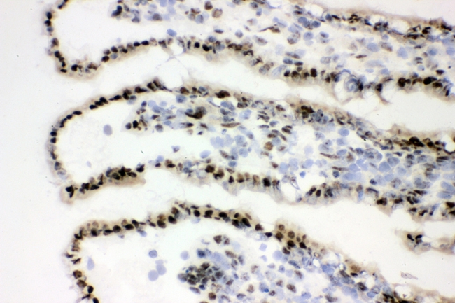 XRCC1 Antibody - IHC analysis of XRCC1 using anti-XRCC1 antibody. XRCC1 was detected in frozen section of rat intestine tissues. Heat mediated antigen retrieval was performed in citrate buffer (pH6, epitope retrieval solution) for 20 mins. The tissue section was blocked with 10% goat serum. The tissue section was then incubated with 1µg/ml rabbit anti-XRCC1 Antibody overnight at 4°C. Biotinylated goat anti-rabbit IgG was used as secondary antibody and incubated for 30 minutes at 37°C. The tissue section was developed using Strepavidin-Biotin-Complex (SABC) with DAB as the chromogen.