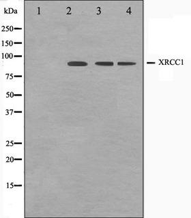 XRCC1 Antibody - Western blot analysis on Jurkat, COS7 and HuvEc cell lysates using XRCC1 antibody. The lane on the left is treated with the antigen-specific peptide.