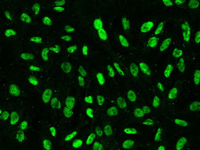 XRCC1 Antibody - Immunofluorescence staining of XRCC1 in U251MG cells. Cells were fixed with 4% PFA, permeabilzed with 0.1% Triton X-100 in PBS, blocked with 10% serum, and incubated with rabbit anti-Human XRCC1 polyclonal antibody (dilution ratio 1:200) at 4°C overnight. Then cells were stained with the Alexa Fluor 488-conjugated Goat Anti-rabbit IgG secondary antibody (green). Positive staining was localized to Nucleus.