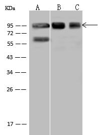 XRCC1 Antibody - Anti-XRCC1 rabbit polyclonal antibody at 1:500 dilution. Lane A: HeLa Whole Cell Lysate. Lane B: Jurkat Whole Cell Lysate. Lane C: HepG2 Whole Cell Lysate. Lysates/proteins at 30 ug per lane. Secondary: Goat Anti-Rabbit IgG (H+L)/HRP at 1/10000 dilution. Developed using the ECL technique. Performed under reducing conditions. Predicted band size: 69 kDa.