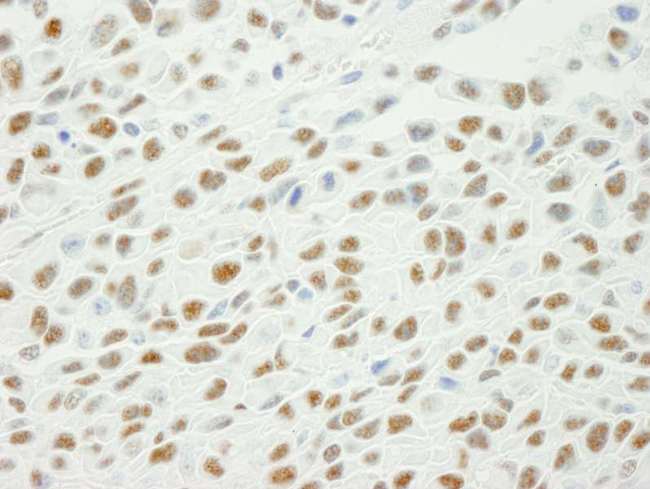 XRCC1 Antibody - Detection of Mouse Phospho XRCC1 (S461) by Immunohistochemistry. Sample: FFPE section of mouse squamous cell carcinoma. Antibody: Affinity purified rabbit anti-Phospho XRCC1 (S461). used at a dilution of 1:250.