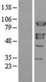 XRCC1 Protein - Western validation with an anti-DDK antibody * L: Control HEK293 lysate R: Over-expression lysate