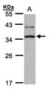 XRCC2 Antibody - Sample. A:30g of Raji whole cell lysate . 12% SDS PAGE. XRCC2 antibody diluted at 1:1000