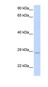 XRCC2 Antibody - XRCC2 antibody Western blot of Fetal Muscle lysate. This image was taken for the unconjugated form of this product. Other forms have not been tested.