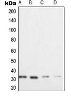 XRCC2 Antibody - Western blot analysis of XRCC2 expression in HeLa (A); Raji (B); SW480 (C); Caco2 (D) whole cell lysates.