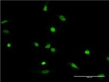 XRCC2 Antibody - Immunofluorescence of monoclonal antibody to XRCC2 on HeLa cell . [antibody concentration 10 ug/ml]
