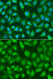 XRCC2 Antibody - Immunofluorescence analysis of A549 cells.