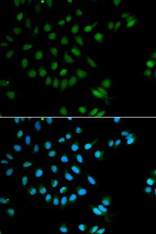 XRCC2 Antibody - Immunofluorescence analysis of MCF-7 cells using XRCC2 antibody. Blue: DAPI for nuclear staining.